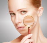 נפרדים לשלום מהפיגמנטציה-תמונה